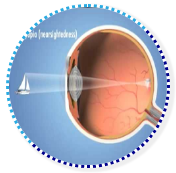 Refractive Image